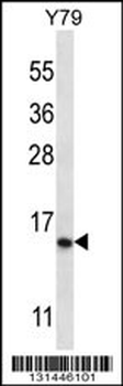 NR2C2AP Antibody (N-term)