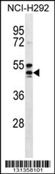 NIACR1 Antibody (Center)