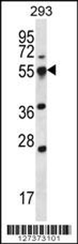 SMAP2 Antibody (Center)