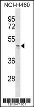 CHST6 Antibody (C-term)