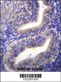 TBPL2 Antibody (N-term)