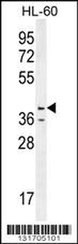 CASP12 Antibody (Center)