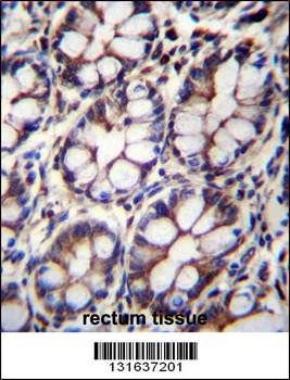 IQCA1 Antibody (C-term)