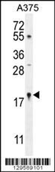 SNR27 Antibody (Center)