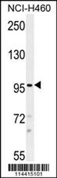 TRPM8 Antibody (N-term)