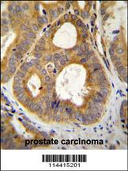 TRPM8 Antibody (N-term)
