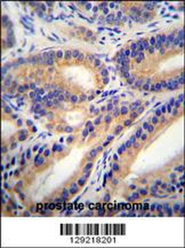 HSD11B1L Antibody (C-term)