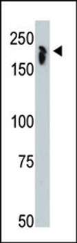 NCOR1 Antibody (N-term)