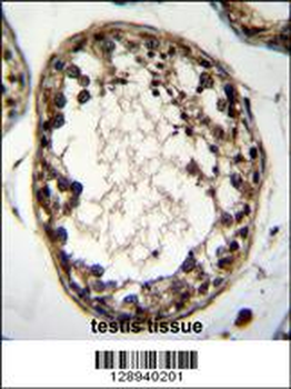 OTUD1 Antibody (Center)