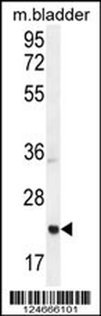 ASCL2 Antibody (N-term)