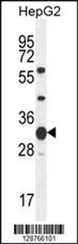 SOHLH1 Antibody (N-term)