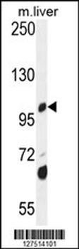 DHTKD1 Antibody (Center)