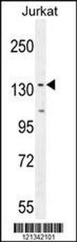 PPP1R3A Antibody (Center)