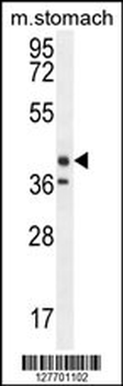 TECTB Antibody (N-term)