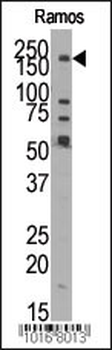 JMJD1B Antibody (N-term)