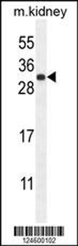 FGF9 Antibody (N-term)