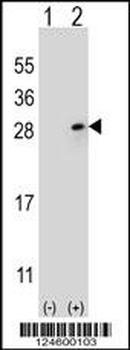 FGF9 Antibody (N-term)