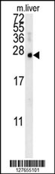 MCEE Antibody (C-term)