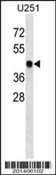 SNX6 Antibody