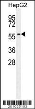 CABC1 Antibody