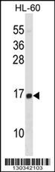 HIST1H2BD Antibody (N-term)