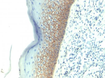 E-Cadherin / CD324 Antibody