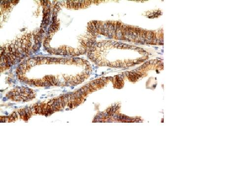 E-Cadherin / CD324 Antibody