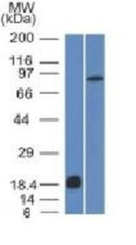 E-Cadherin / CD324 Antibody