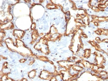 CD31 / PECAM-1 Antibody