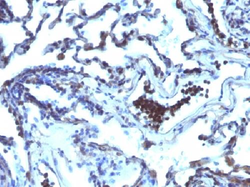 TDP2 / EAPII Antibody