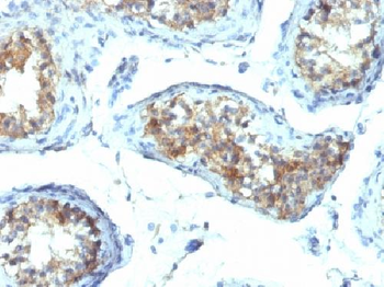 Interferon gamma (IFNG) Antibody