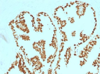 FOXA1 / HNF3A Antibody