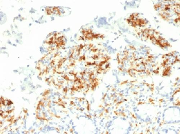 CD209 / DC-SIGN Antibody