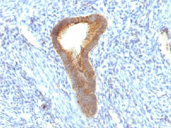 Alkaline Phosphatase (Tissue-Nonspecific) Antibody