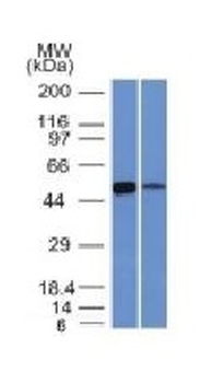 ALDH1A1 (Aldehyde Dehydrogenase 1A1) Antibody