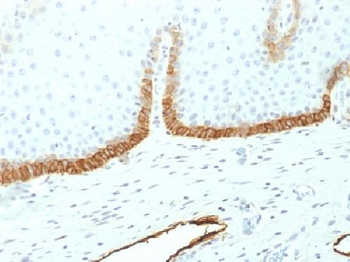 Podoplanin (PDPN) Antibody