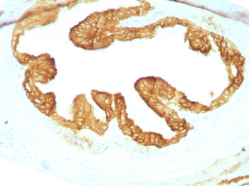 Cytokeratin, pan (Epithelial Marker) Antibody - With BSA and Azide