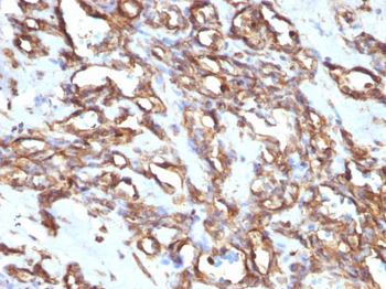 Vimentin (Mesenchymal Cell Marker) Antibody - With BSA and Azide