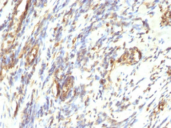 Vimentin (Mesenchymal Cell Marker) Antibody - With BSA and Azide