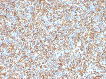 Vimentin (Mesenchymal Cell Marker) Antibody - With BSA and Azide