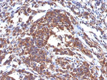 Vimentin (Mesenchymal Cell Marker) Antibody - With BSA and Azide