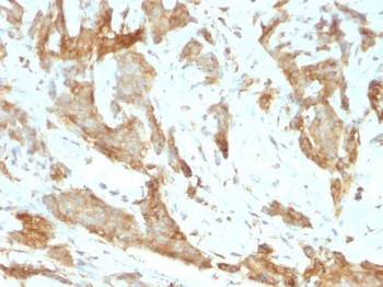 GRP94 / HSP90B1 (Endoplasmic Reticulum Marker) Antibody - With BSA and Azide