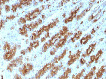 TNF-alpha (Tumor Necrosis Factor alpha) Antibody - With BSA and Azide
