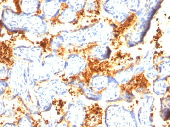 Transglutaminase II (TGM2) Antibody - With BSA and Azide