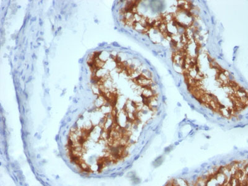 Fascin-1 (Reed-Sternberg Cell Marker) Antibody - With BSA and Azide