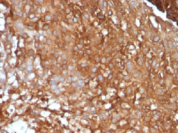 Beta-2 Microglobulin (Renal Failure & Tumor Marker) Antibody - With BSA and Azide