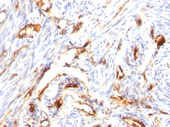 Beta-2 Microglobulin (Renal Failure & Tumor Marker) Antibody - With BSA and Azide