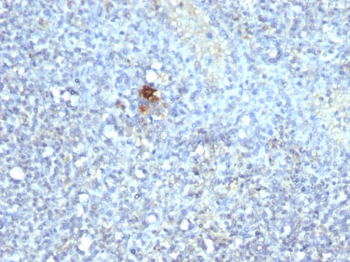 TRAcP (Tartrate-Resistant Acid Phosphatase) (Hairy Cell Leukemia Marker) Antibody - With BSA and Az