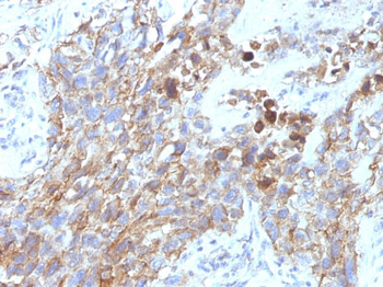 CD56 / NCAM1 / NKH1 (Neuronal Cell Marker) Antibody - With BSA and Azide