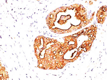 MUC1 / EMA / CD227 (Epithelial Marker) Antibody - With BSA and Azide